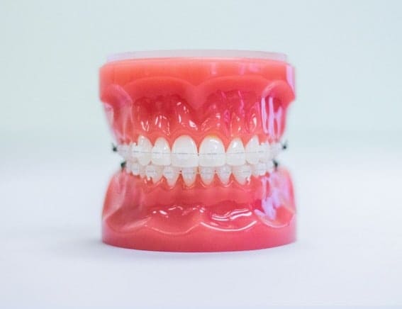 clear braces at las vegas orthodontist